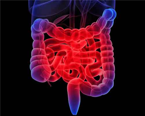 Boala Crohn Cauze, simptome, dietă - Sănătate - 